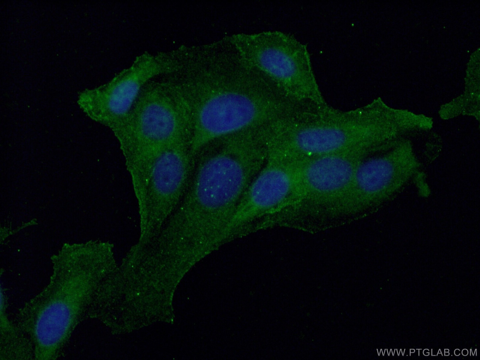 Galectin-1