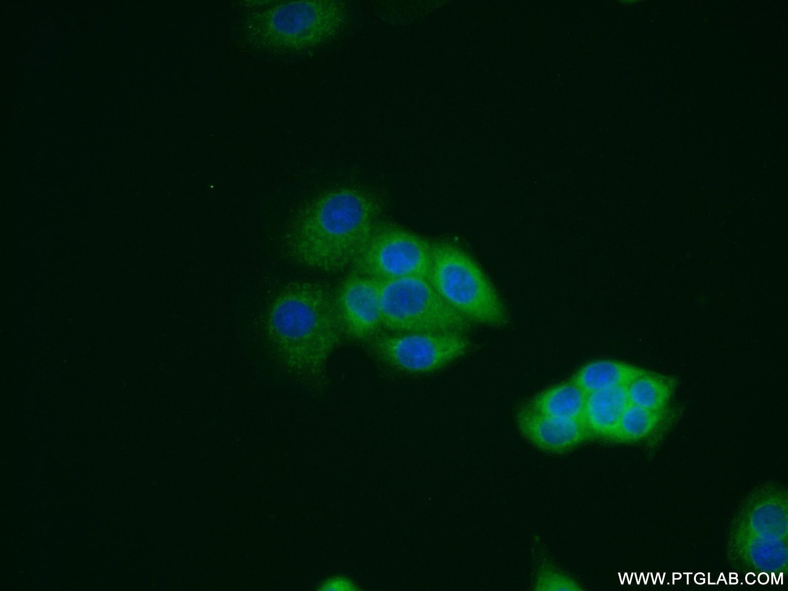 Galectin-3