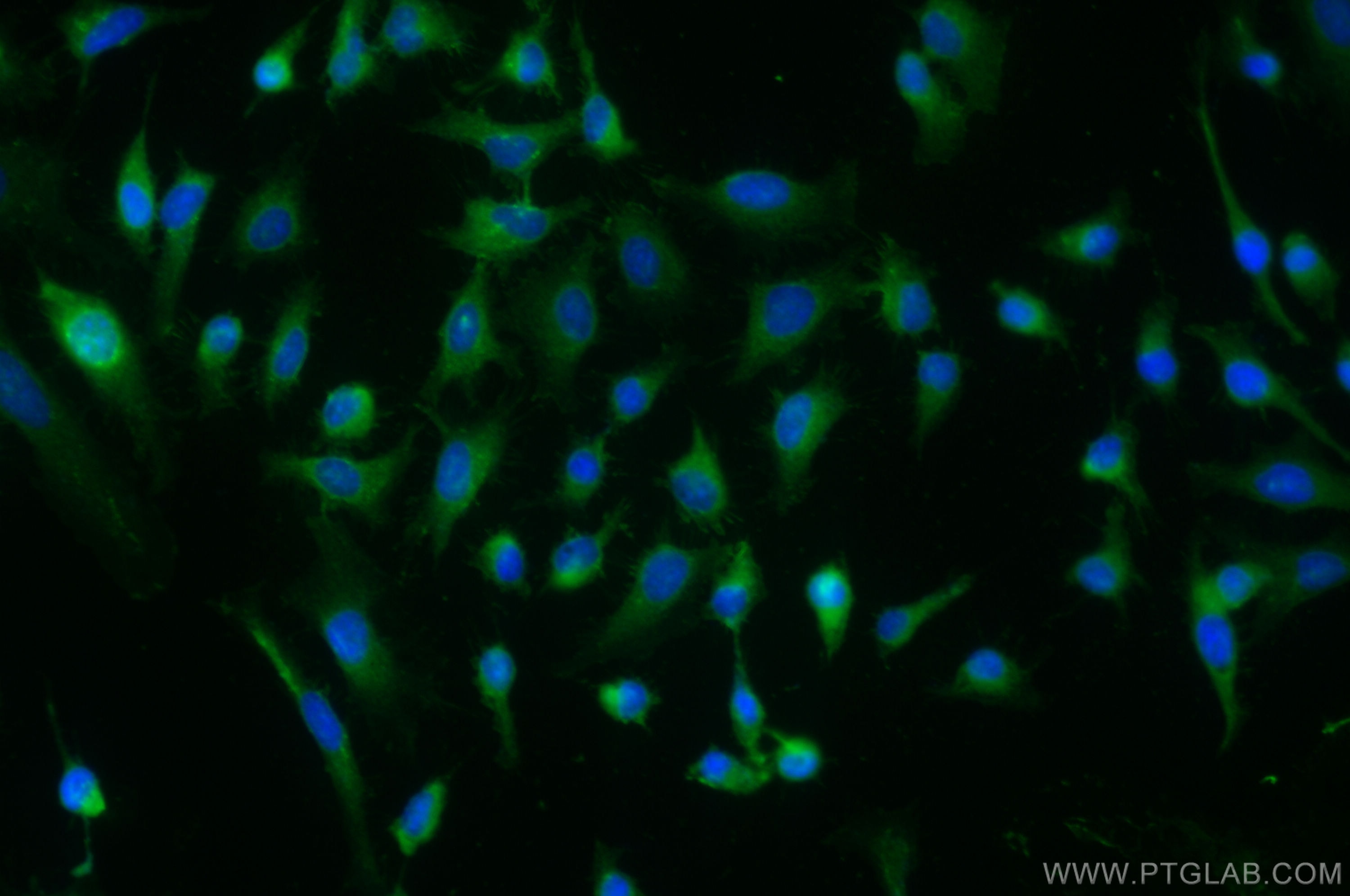 Immunofluorescence (IF) / fluorescent staining of HeLa cells using Galectin-3 Polyclonal antibody (14979-1-AP)