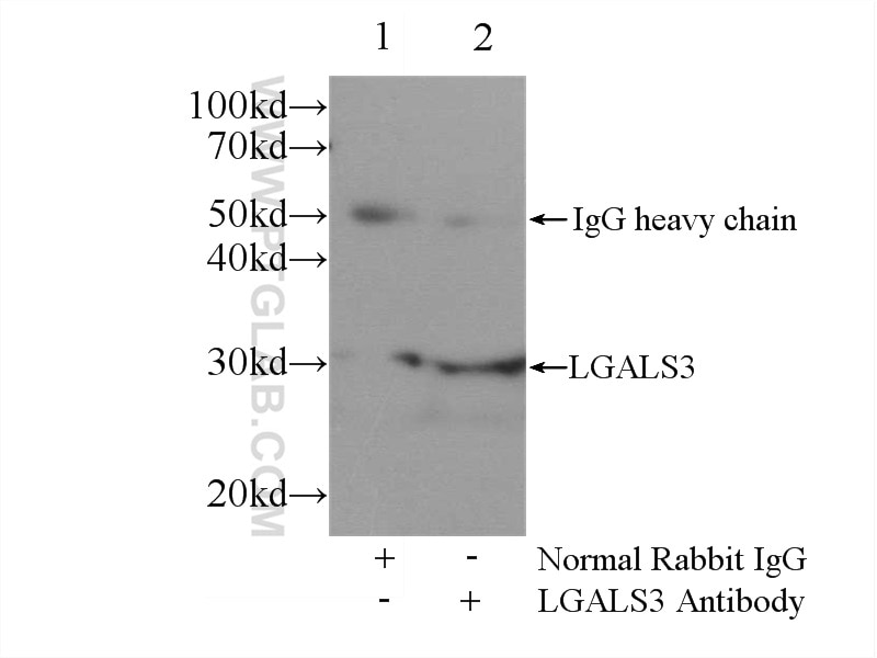 Immunoprecipitation (IP) experiment of MCF-7 cells using Galectin-3 Polyclonal antibody (14979-1-AP)