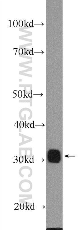 Galectin-3 Polyclonal antibody