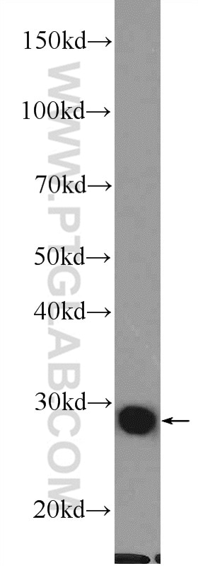 Western Blot (WB) analysis of rat colon tissue using Galectin-3 Polyclonal antibody (14979-1-AP)