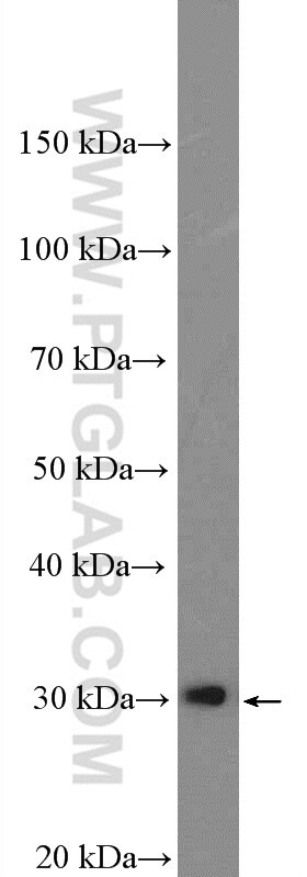 Western Blot (WB) analysis of HeLa cells using Galectin-3 Polyclonal antibody (14979-1-AP)