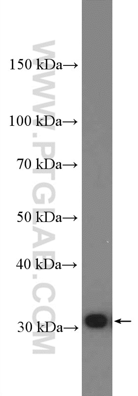 Galectin-3 Polyclonal antibody