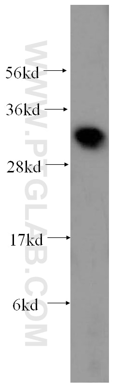 Western Blot (WB) analysis of human heart tissue using Galectin-3 Polyclonal antibody (14979-1-AP)