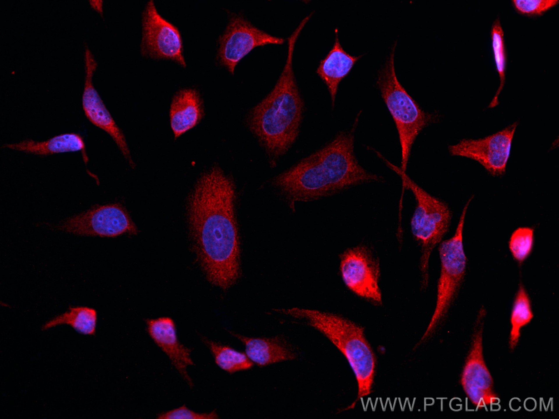 Immunofluorescence (IF) / fluorescent staining of HeLa cells using Galectin-3 Monoclonal antibody (60207-1-Ig)