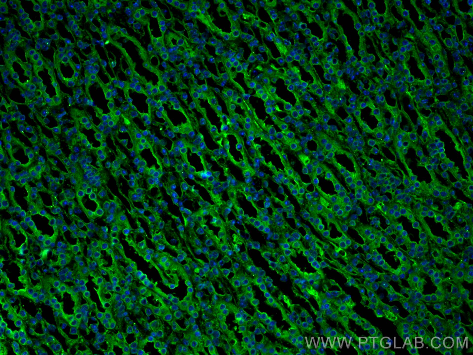 Immunofluorescence (IF) / fluorescent staining of mouse kidney tissue using Galectin-3 Monoclonal antibody (60207-1-Ig)