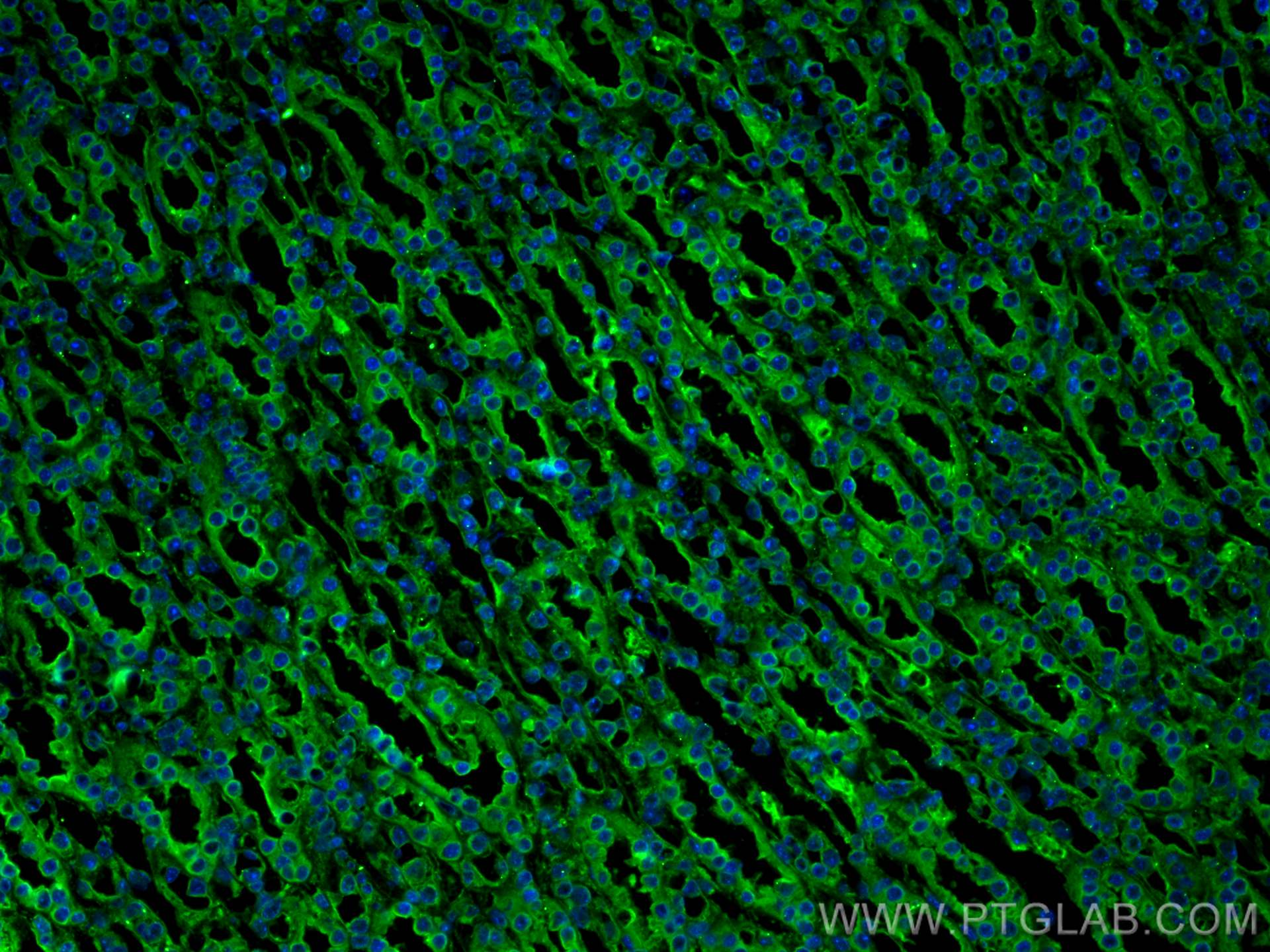 IF Staining of mouse kidney using 60207-1-Ig