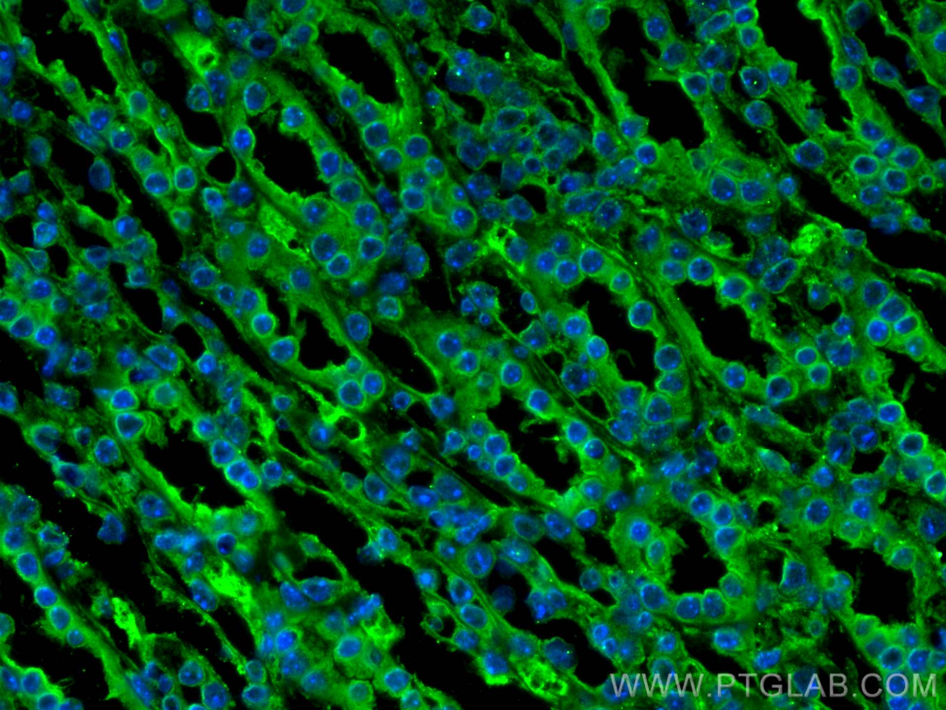 IF Staining of mouse kidney using 60207-1-Ig