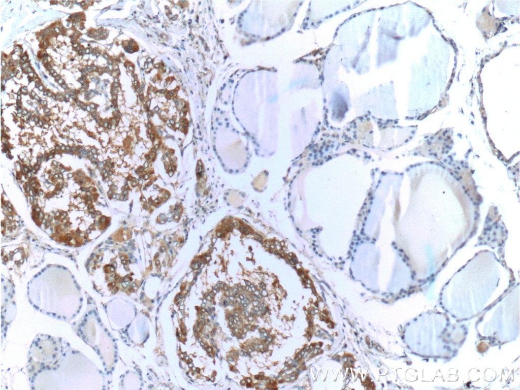 Galectin-3 Monoclonal antibody