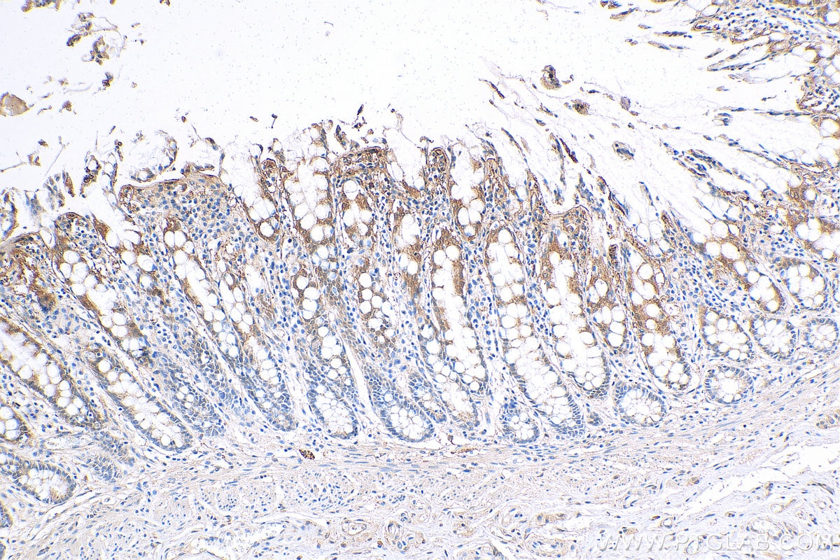 Immunohistochemistry (IHC) staining of human colon tissue using Galectin-3 Monoclonal antibody (60207-1-Ig)