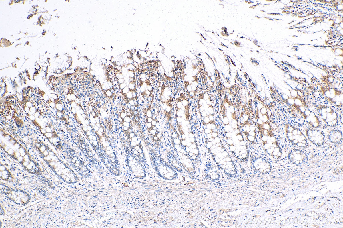 IHC staining of human colon using 60207-1-Ig