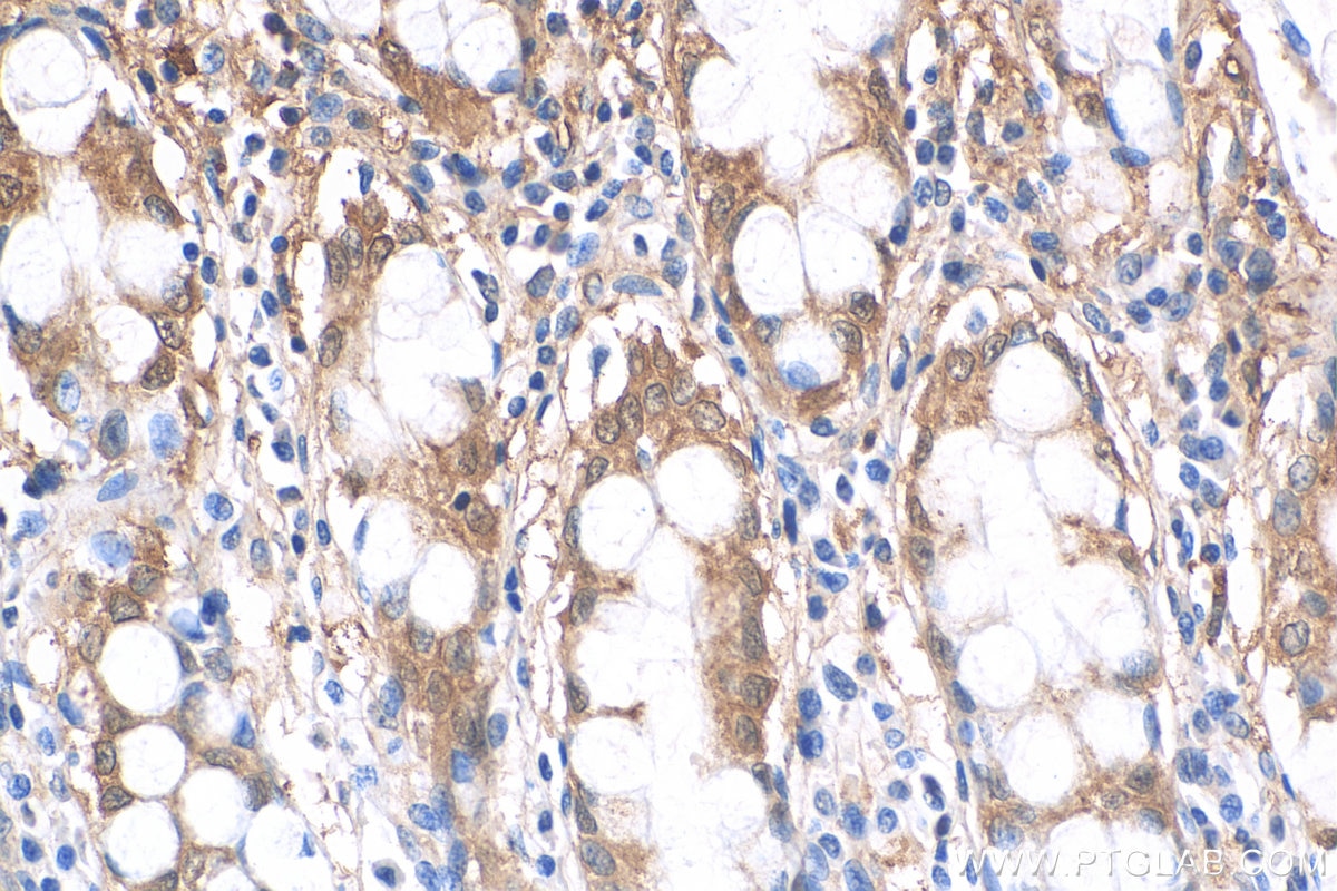 Immunohistochemistry (IHC) staining of human colon tissue using Galectin-3 Monoclonal antibody (60207-1-Ig)