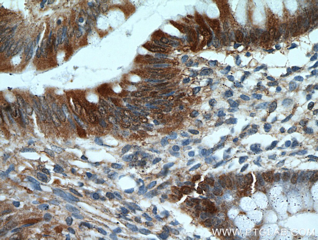 Immunohistochemistry (IHC) staining of human colon tissue using Galectin-3 Monoclonal antibody (60207-1-Ig)
