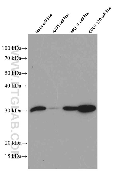 Western Blot (WB) analysis of HeLa cells using Galectin-3 Monoclonal antibody (60207-1-Ig)