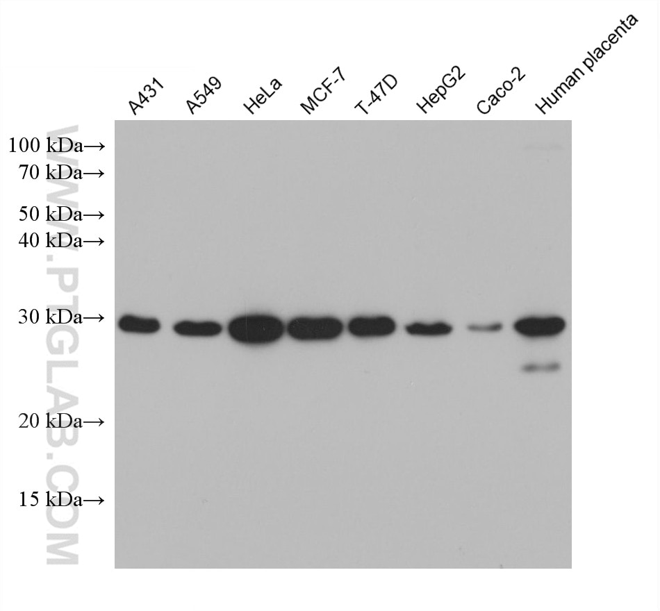 Western Blot (WB) analysis of various lysates using Galectin-3 Monoclonal antibody (60207-1-Ig)