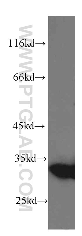 Western Blot (WB) analysis of HeLa cells using Galectin-3 Monoclonal antibody (60207-1-Ig)