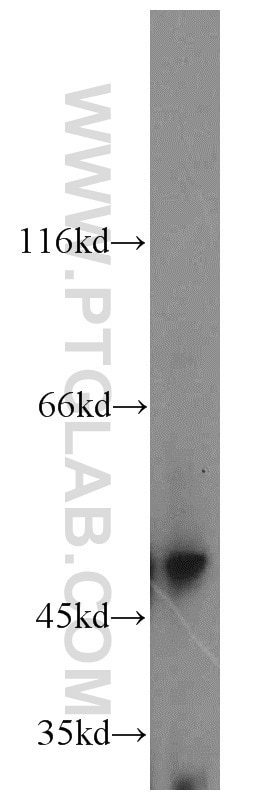 Western Blot (WB) analysis of HEK-293 cells using GAL3ST1 Polyclonal antibody (18503-1-AP)