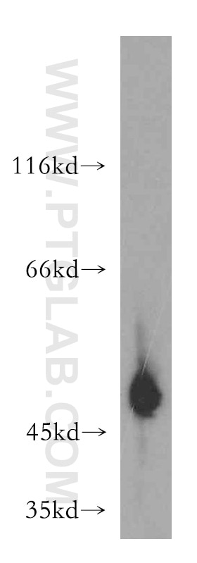 Western Blot (WB) analysis of SGC-7901 cells using GAL3ST1 Polyclonal antibody (18503-1-AP)