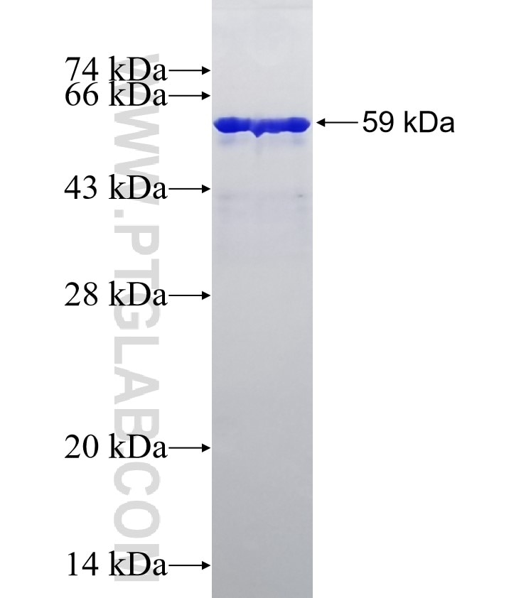 GAL3ST1 fusion protein Ag13353 SDS-PAGE