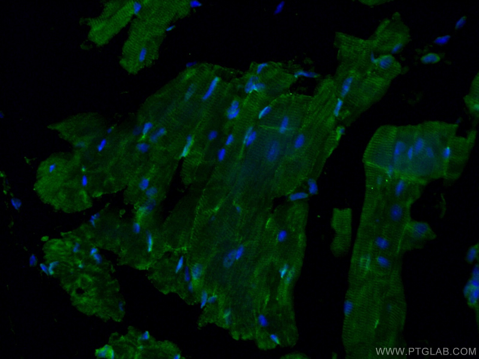 IF Staining of mouse heart using 24851-1-AP