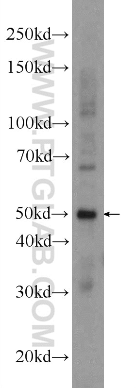 Western Blot (WB) analysis of mouse brain tissue using GAL3ST3 Polyclonal antibody (24851-1-AP)