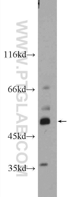 Western Blot (WB) analysis of mouse kidney tissue using GAL3ST3 Polyclonal antibody (24851-1-AP)