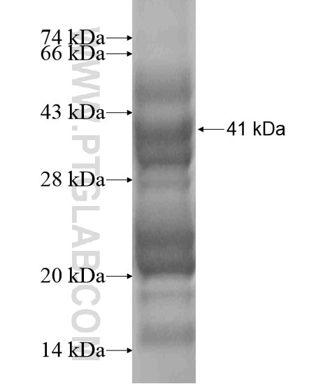GAL3ST3 fusion protein Ag20692 SDS-PAGE