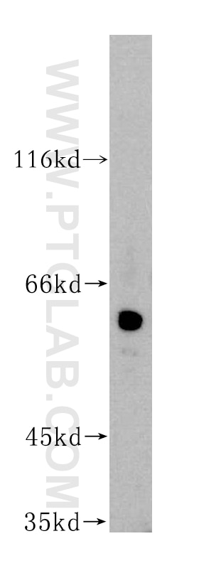 Western Blot (WB) analysis of human placenta tissue using GAL3ST4 Polyclonal antibody (16240-1-AP)