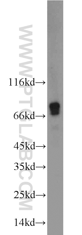Western Blot (WB) analysis of mouse brain tissue using GALC Polyclonal antibody (12887-1-AP)