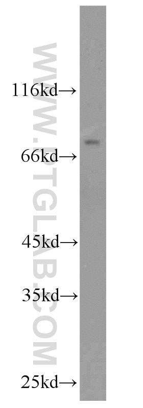 Western Blot (WB) analysis of HeLa cells using GALC Polyclonal antibody (12887-1-AP)