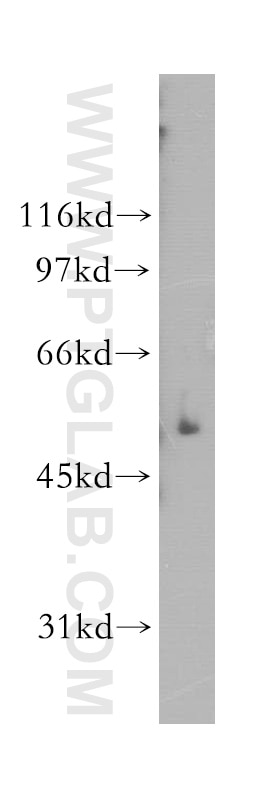 Western Blot (WB) analysis of human placenta tissue using GALC Polyclonal antibody (12887-1-AP)