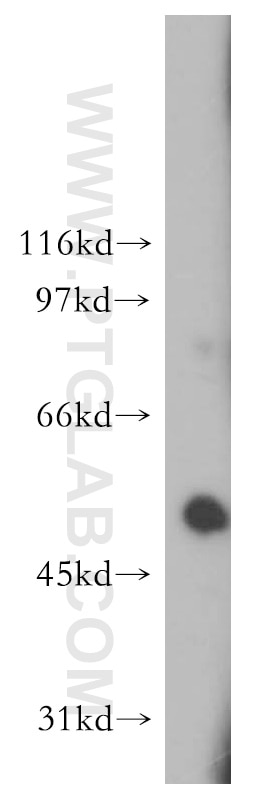 Western Blot (WB) analysis of A375 cells using GALC Polyclonal antibody (12887-1-AP)