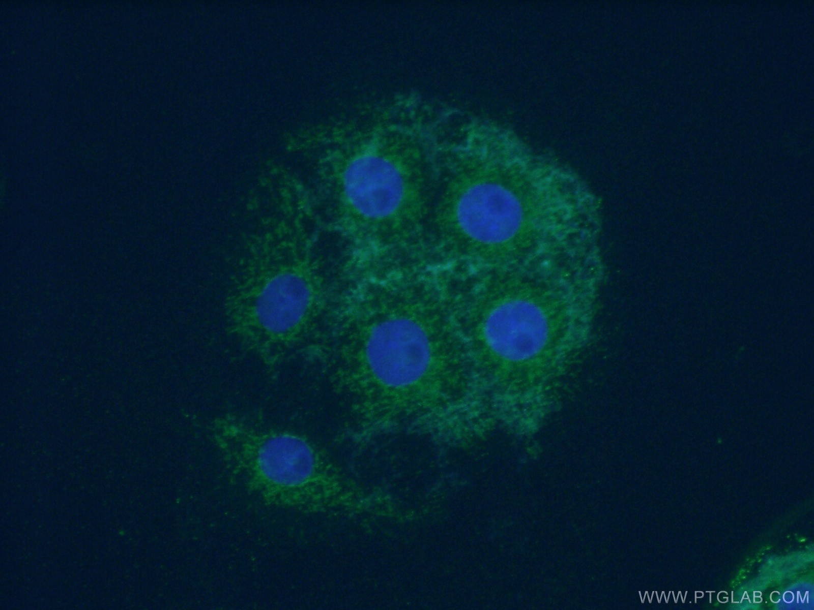 IF Staining of SH-SY5Y using 51051-2-AP