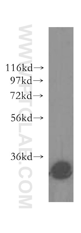 Western Blot (WB) analysis of human brain tissue using GALC Polyclonal antibody (51051-2-AP)