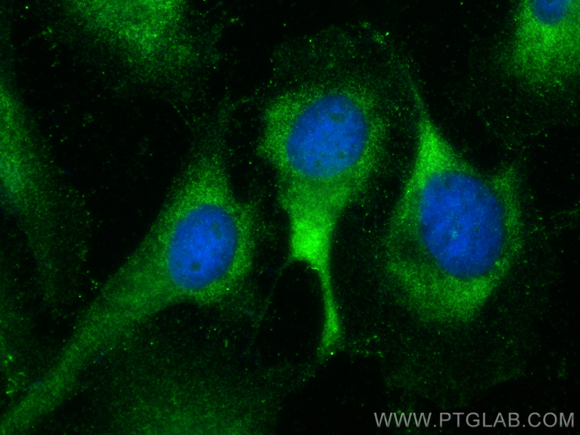 Immunofluorescence (IF) / fluorescent staining of HeLa cells using GALE Polyclonal antibody (14414-1-AP)