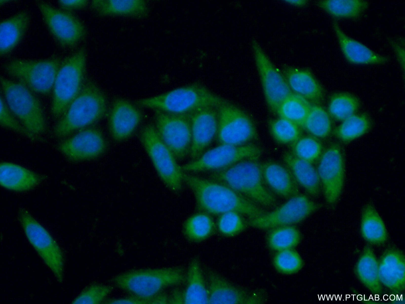 Immunofluorescence (IF) / fluorescent staining of HeLa cells using GALE Polyclonal antibody (14414-1-AP)