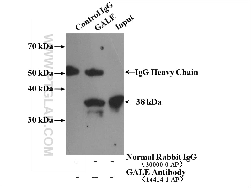 Immunoprecipitation (IP) experiment of HeLa cells using GALE Polyclonal antibody (14414-1-AP)