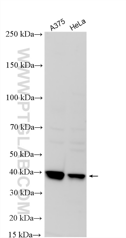 WB analysis using 14414-1-AP Western Blot (WB) analysis of various lysates using GALE Polyclonal antibody (14414-1-AP)