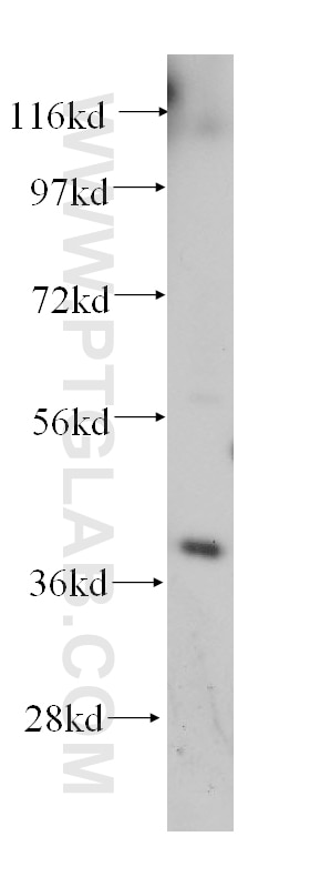 Western Blot (WB) analysis of HeLa cells using GALE Polyclonal antibody (14414-1-AP)
