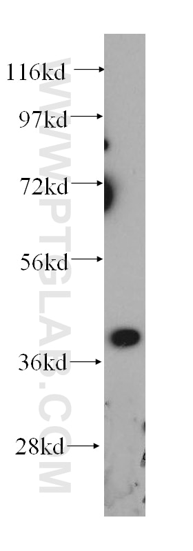 Western Blot (WB) analysis of A375 cells using GALE Polyclonal antibody (14414-1-AP)