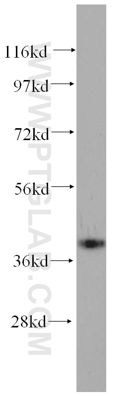 Western Blot (WB) analysis of MCF-7 cells using GALE Polyclonal antibody (14414-1-AP)