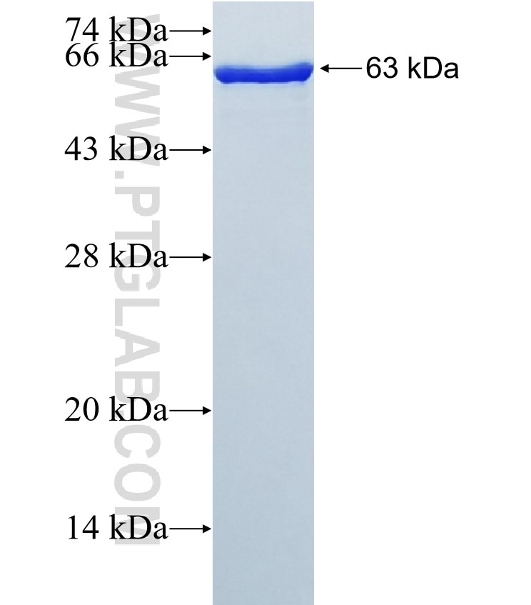 GALE fusion protein Ag5756 SDS-PAGE