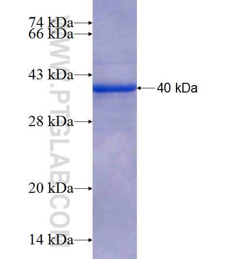 GALE fusion protein Ag6571 SDS-PAGE