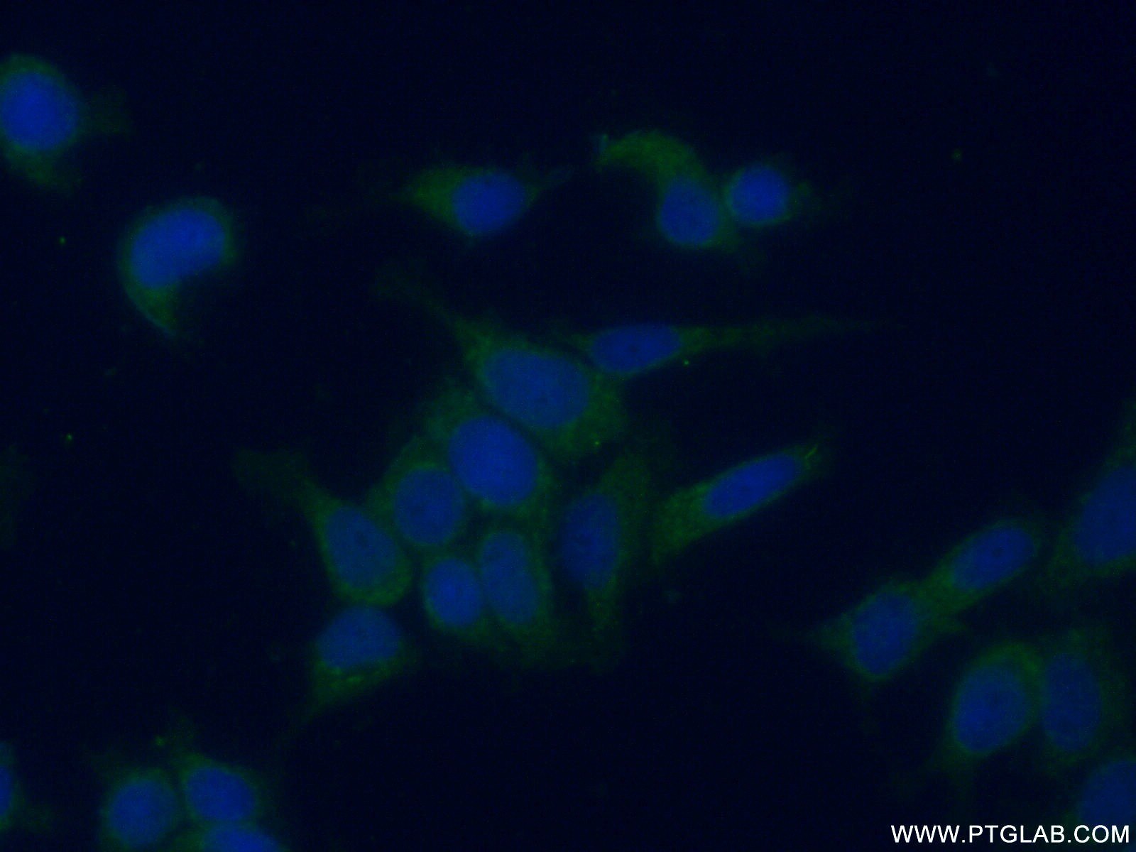 Immunofluorescence (IF) / fluorescent staining of MCF-7 cells using GALK1 Polyclonal antibody (15284-1-AP)