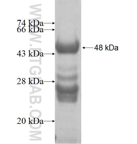 GALK1 fusion protein Ag7300 SDS-PAGE GALK1 fusion protein Ag7300 SDS-PAGE