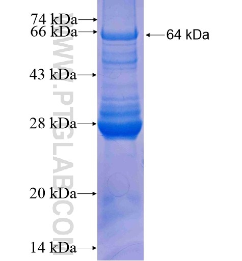 GALK1 fusion protein Ag7403 SDS-PAGE