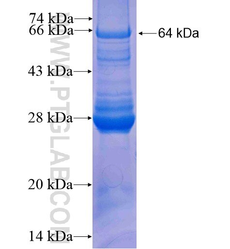 GALK1 fusion protein Ag7403 SDS-PAGE