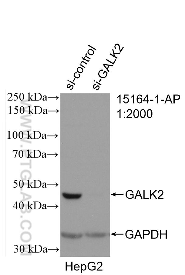 Western Blot (WB) analysis of HepG2 cells using GALK2 Polyclonal antibody (15164-1-AP)