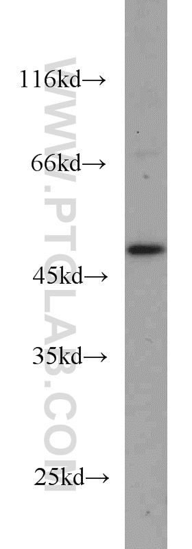 Western Blot (WB) analysis of HL-60 cells using GALK2 Polyclonal antibody (15164-1-AP)